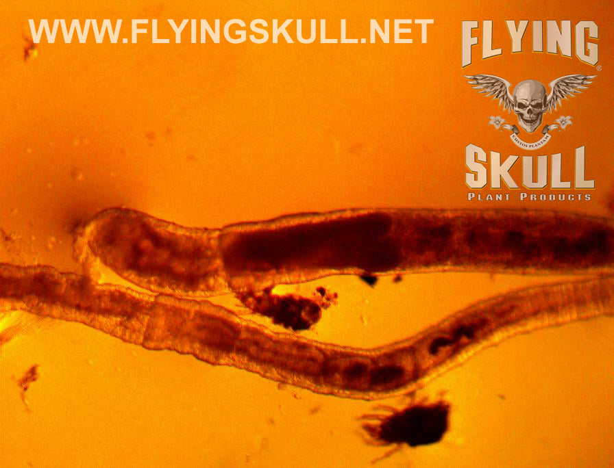 Nematodes